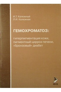 Гемохроматоз: гиперпигментация кожи пигментный цирроз. Калюжный