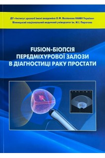 Fusion-біопсія передміхурової залози в діагностиці раку простати. Монографія. Возіанов С.О. та ін.