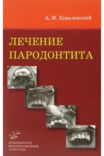 Лечение пародонтита: Практическое руководство.. Ковалевский А.М.
