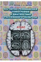 Магнитно-резонансная томография в диагностике рассеянного склероза. Атлас. Мягков А.П.