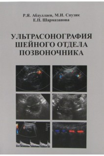 Ультрасонография шейного отдела позвоночника. Абдуллаев Р.Я. Спузяк М.И.