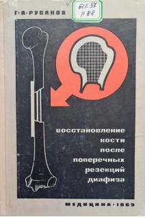 Восстановление кости после поперечных резекций диафиза (БУ). Русанов Г.А.