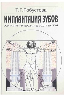 Имплантация зубов. Хирургические аспекты. Робустова Т.Г.