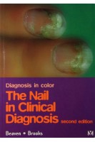 The Nail in Clinical Diagnosis 2nd Edition. D. W. Beaven Stafford E. Brooks