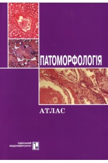 Патоморфологія. Атлас: навчальний посібник. Ситнікова В.О. Ульянов В.О.