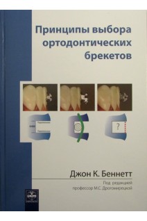 Принципы выбора ортодонтических брекетов. Беннетт Джон К.