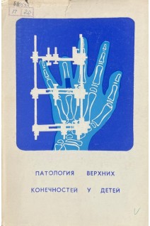 Патология верхних конечностей у детей (БУ). Овсянкин Н.А.
