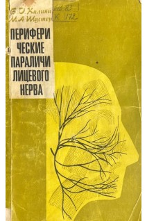 Периферические параличи лицевого нерва (БУ). Калина В.О.