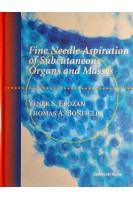 Fine Needle Aspiration of Subcutneous Organs and Masses. Yener S. Erozan Thomas A. Bonfiglio