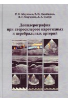 Допплерография при атеросклерозе каротидных и церебральных артерий. Абдуллаев Р.Я. Цымбалюк В.И. Марченко В.Г. Сысун Л.А.