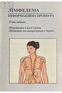 Лімфедема. Інформаційна брошура (БУ). Саскія Сіаденс