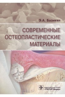 Современные остеопластические материалы. Базикян Э.А.