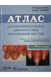 Дифференциальная диагностика поражений ногтей. Атлас. Бэран Р. Ханеке Э. Перевод с англ. Хармандарян И.В. / Под ред. В.Ю. Васеновой