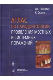 Атлас по пародонтологии. Проявления местных и системных поражений.. Ласкарис Дж.