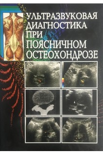 Ультразвуковая диагностика при поясничном остеохондрозе. Учебное пособие. Р.Я.Абдуллаев А.Н. Хвисюк Л.А. Дзяк