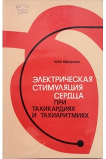 Электрическая стимуляция сердца при тахикардиях и тахиаритмиях. Бредикис Ю.Ю.