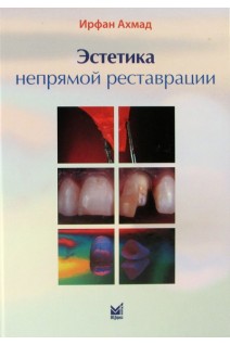 Эстетика непрямой реставрации. Ирфан Ахмад