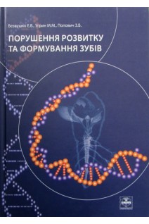 Порушення розвитку та формування зубів. Безвушко Е.В. Угрин М.М.