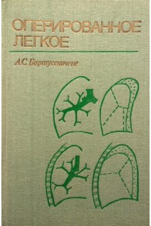 Оперированное легкое (БУ). Бартусевичене А.С.