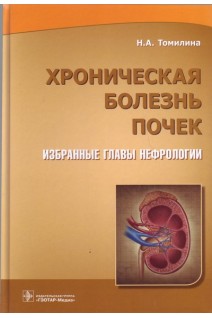 Хроническая болезнь почек. Избранные главы нефрологии. Томилина Н.А.