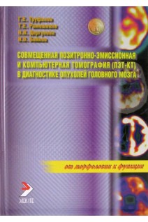 Совмещенная позитронно-эмиссионная и компьюторная томография (ПЭТ-КТ) в диагностике опухолей головного мозга. Труфанов Г.Е. Рязанов В.В. Черемисин В.М.