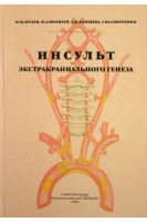 Инсульт экстракраниального генеза. Жулев Н.М.
