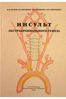 Инсульт экстракраниального генеза. Жулев Н.М.
