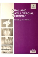 Oral and Maxillofacial Surgery (Хірургічна стоматологія та щелепно-лицева хірургія) Ч.1. Підручник . Malanchuk V.O. (Маланчук В. О. та ін.)