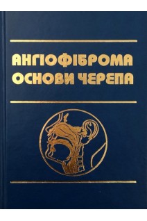 Ангіофіброма основи черепа. Заболотний Д.І. Тімен Г.Е. Лайко А.А. та інші