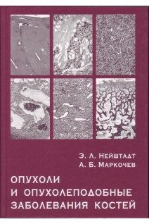 Опухоли и опухолеподобные заболевания костей. Нейштадт Э.Л. Маркочев А.Б.